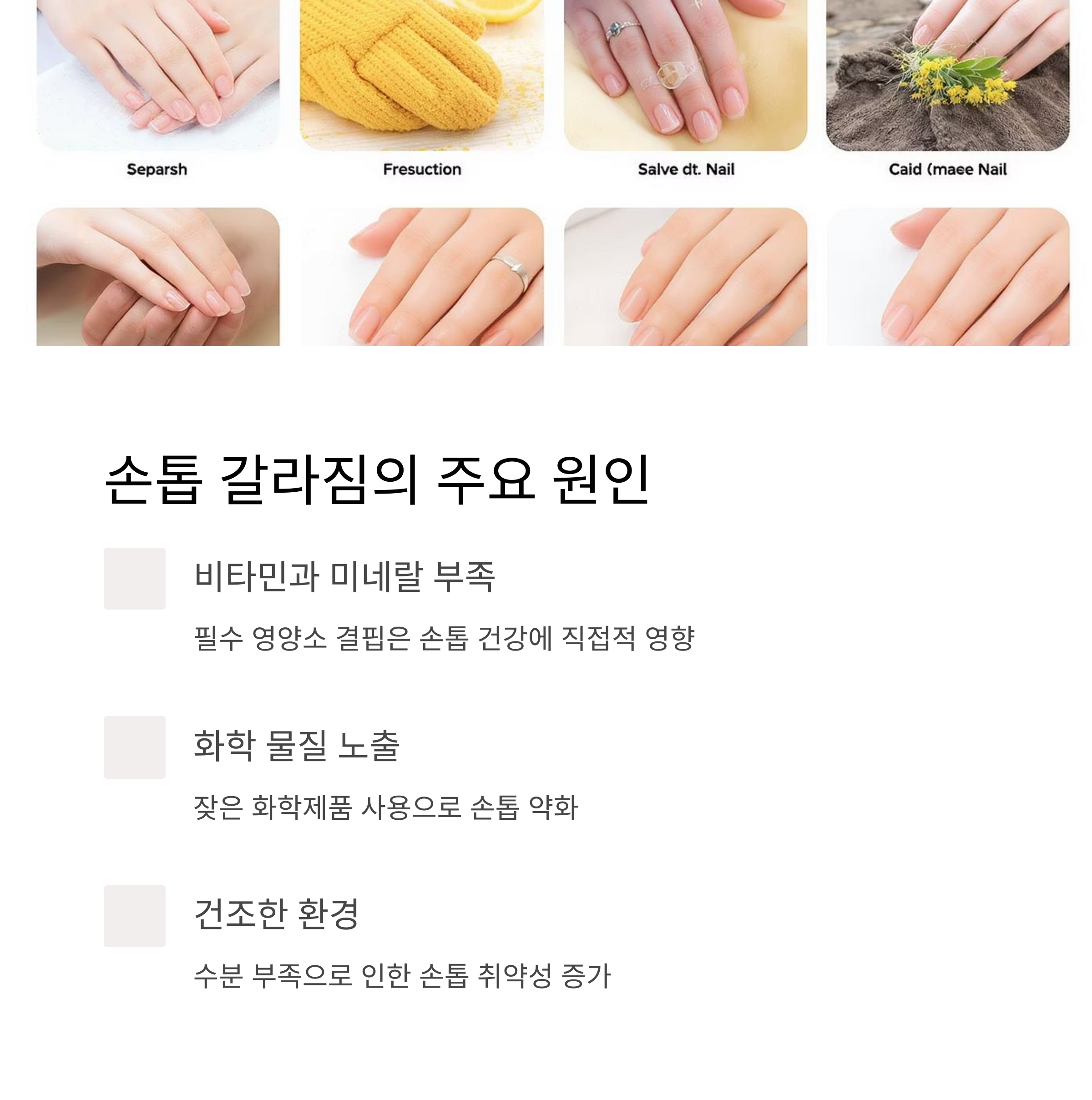 손톱 갈라짐의 주요 원인