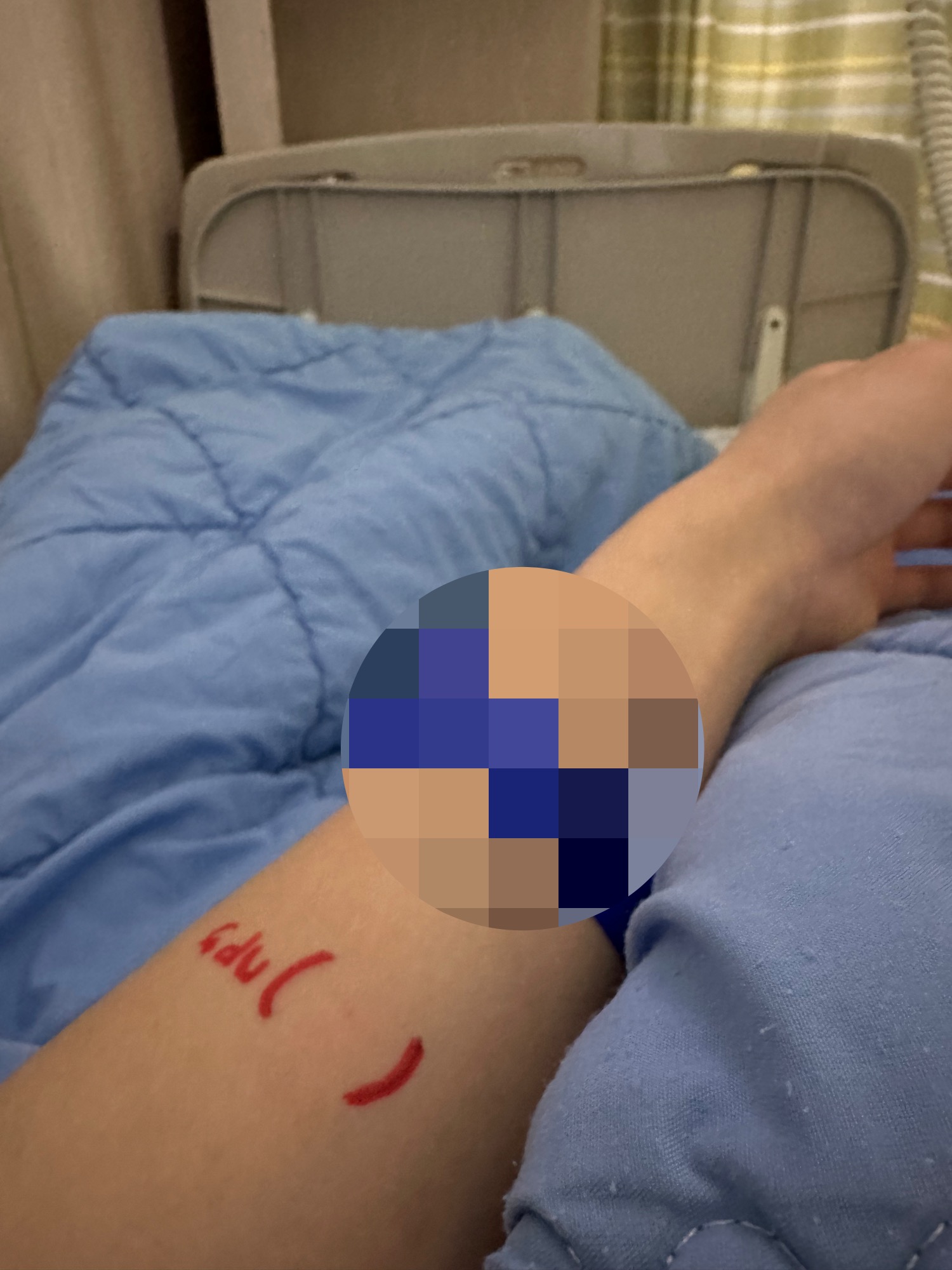 항생제-알레르기-테스트