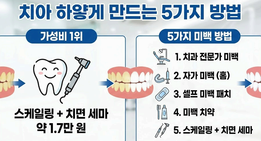 누런 치아, 비싼 미백 대신 '이것'부터 하세요!