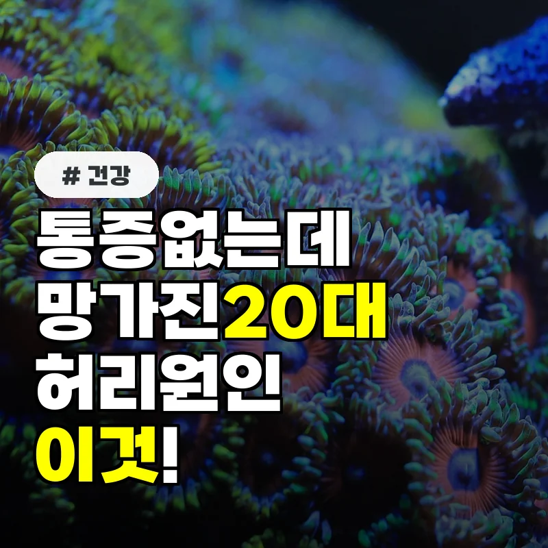 통증 없는데 허리가 왜 이렇지 20대 망가지는 척추의 진짜 원인 3가지