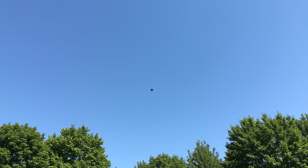 비문증 원인부터 관리 방법까지 2