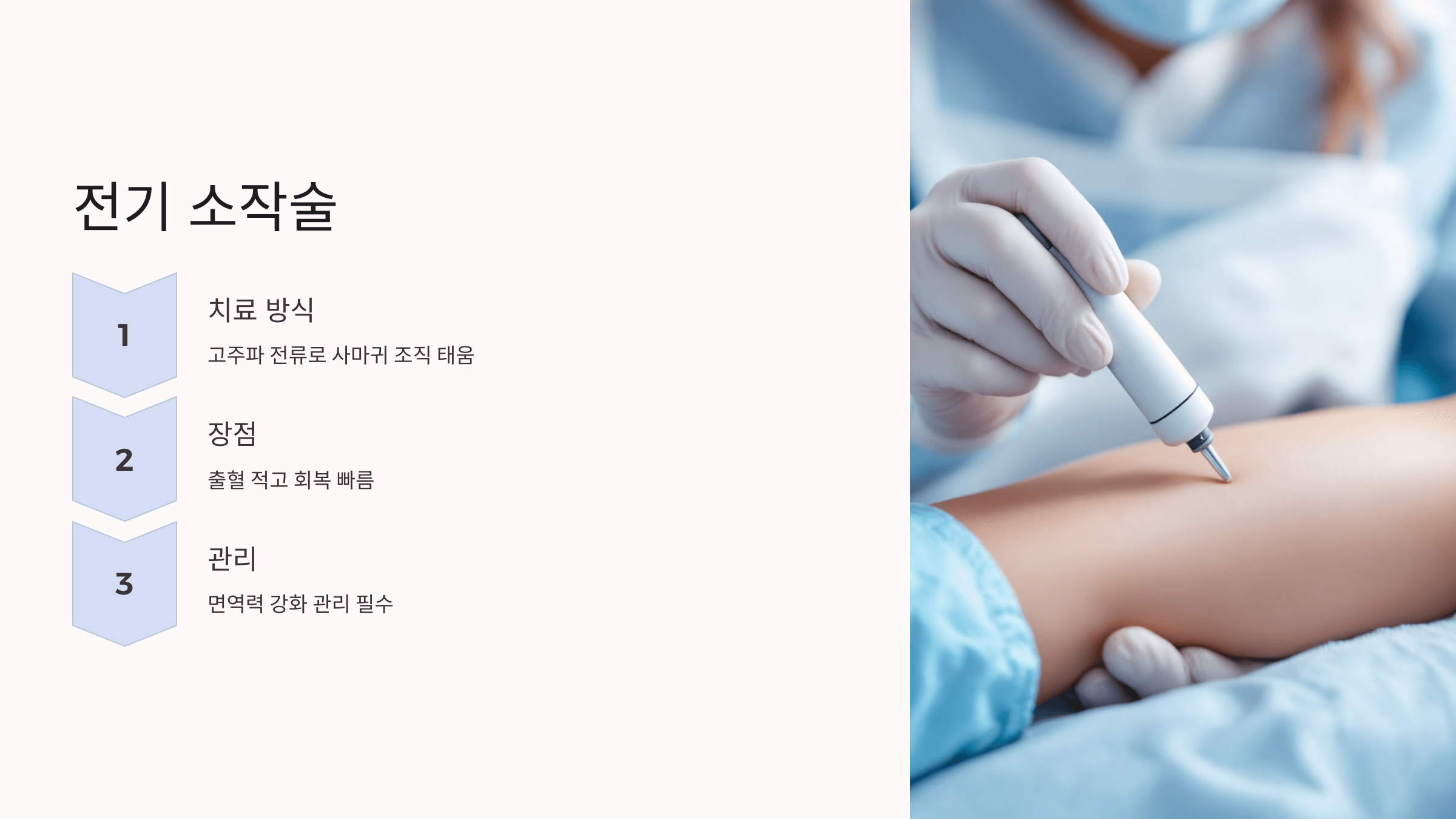 편평사마귀와 관련된 사진입니다.