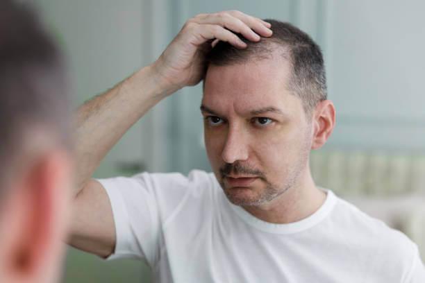 탈모 예방에 좋은 영양제 BEST 5 추천 💊