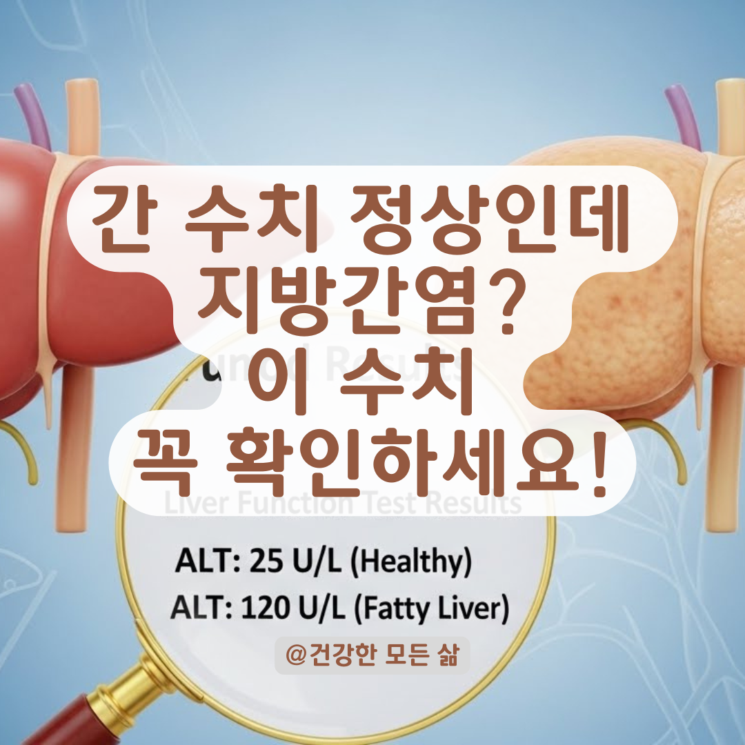 간 수치 ALT, AST만 믿으시나요? 지방간염 숨겨진 신호 잡는 법.