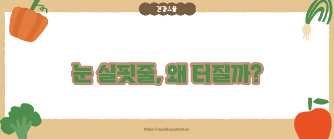 눈 실핏줄이 터지는 이유 (+주의할 질환)