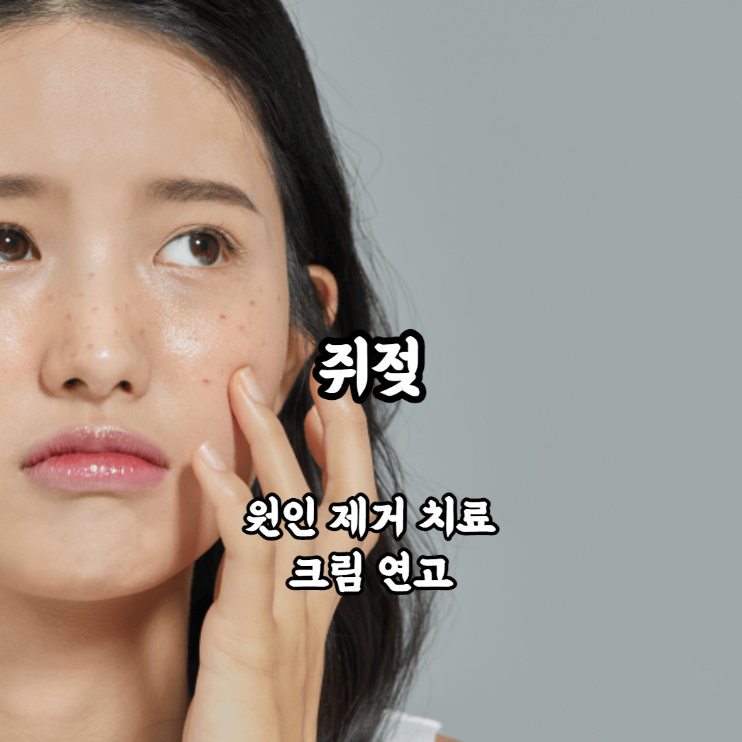 쥐젖 원인 제거 방법 크림 연고