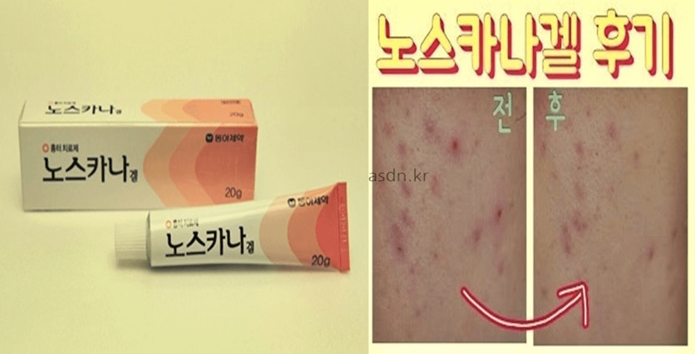 노스카나겔 효능 효과,성분,가격,부작용 총정리