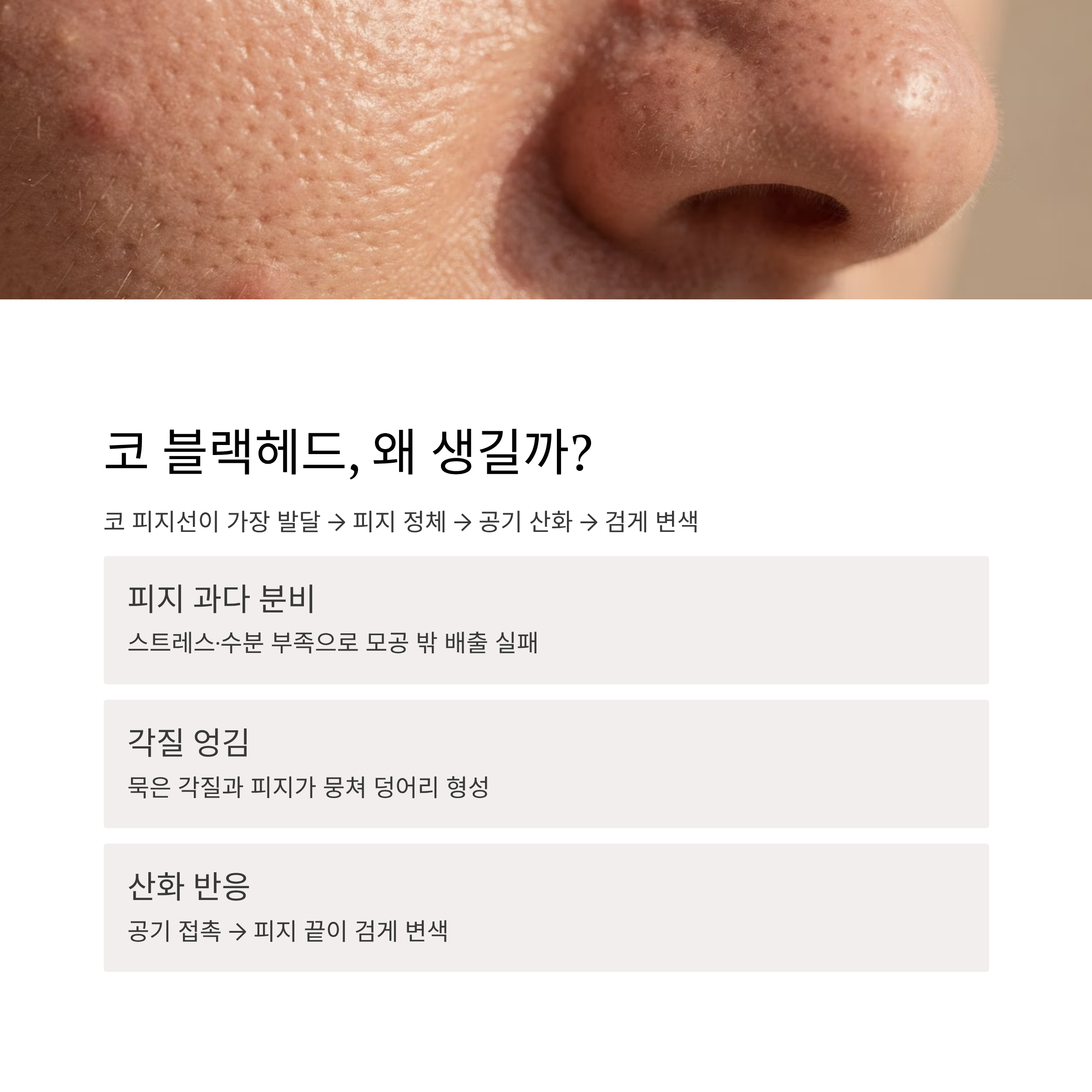 블랙헤드 발생 원인