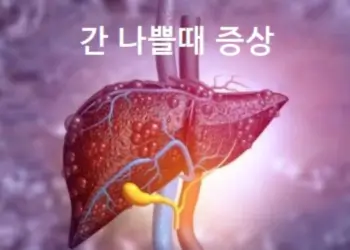 간 나쁠때 증상