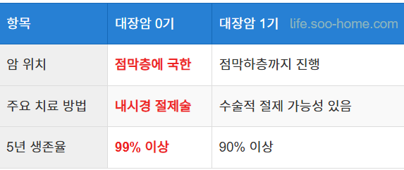 대장암 0기와 1기의 차이점