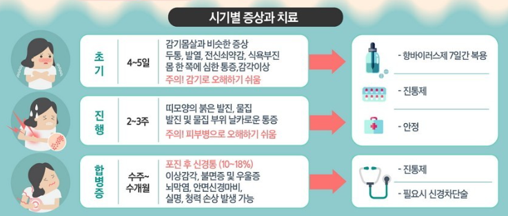 대상포진 시기별 증상과 치료법