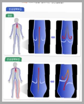 엔테론정 150mg 효능 부작용