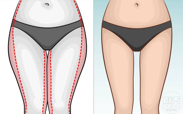 허벅지 안쪽살 빼기 홈필라테스