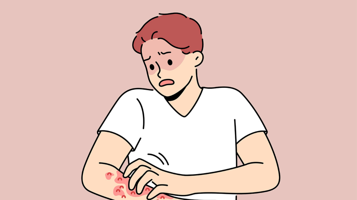 엠폭스-증상사진-감염경로