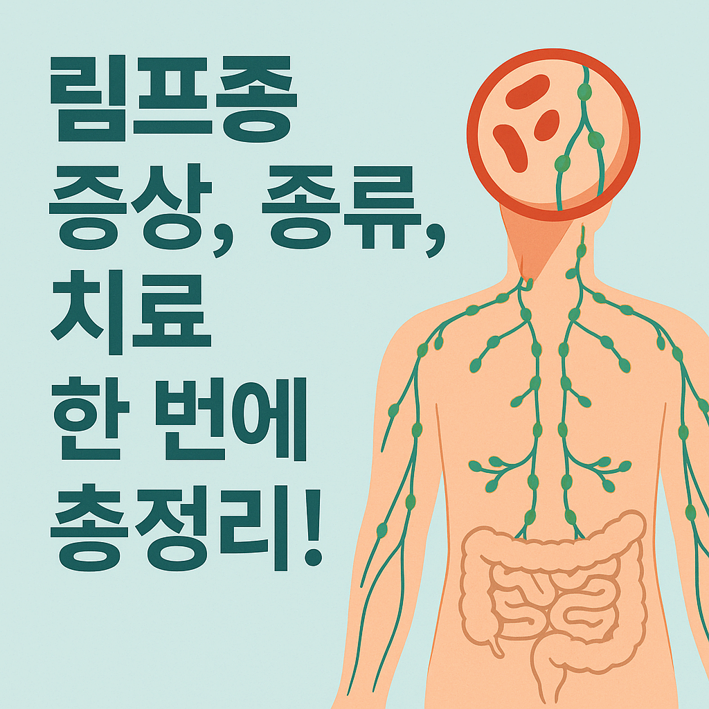 림프종 – 증상부터 종류, 치료까지 한눈에 정리
