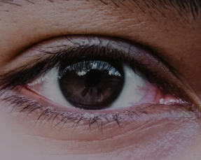 녹내장 치료법 진단 기준 합병증