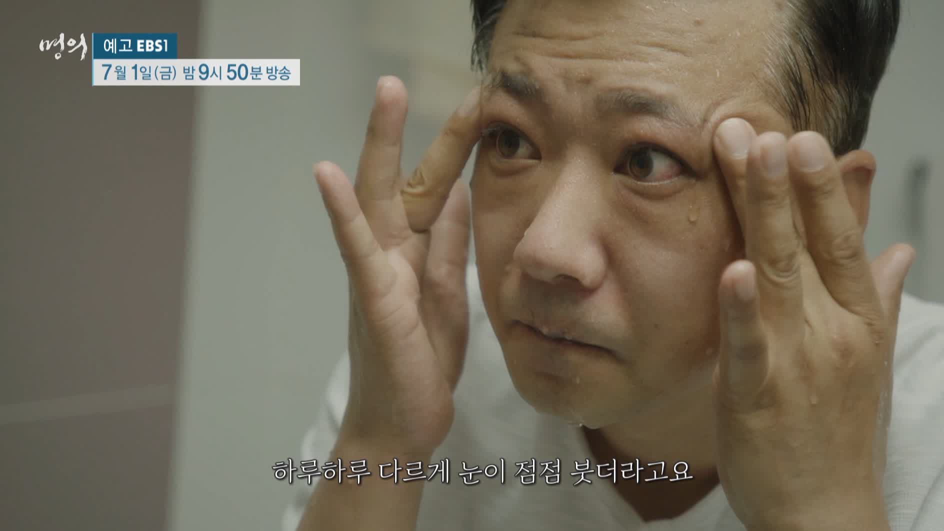 명의 갑상선호르몬 성장호르몬 쿠싱증후군 나잇살 고도비만 골다공증 호르몬 극복 치료법 내분비 내과 안철우 교수