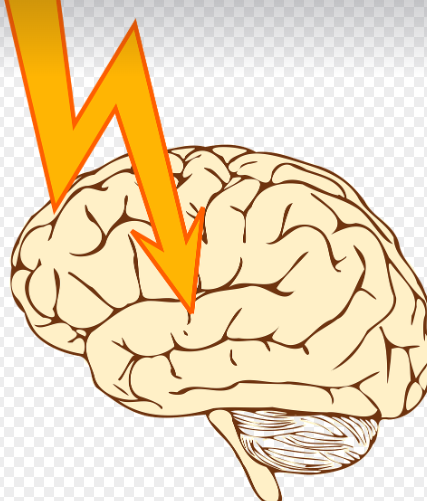 뇌졸중 예방과 이해, 한 순간에 삶을 바꾸는 질병.