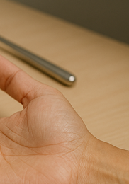 방아쇠 수지 증후군