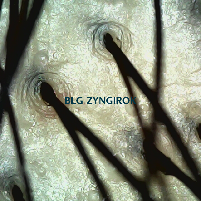 탈모 극복 프로젝트 - 정수리 두피모습이다.