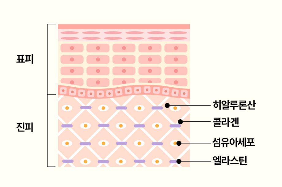 엘라스틴 이란