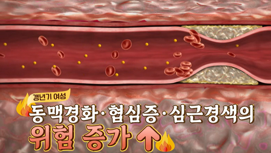 갱년기 유산균 YT1 효능