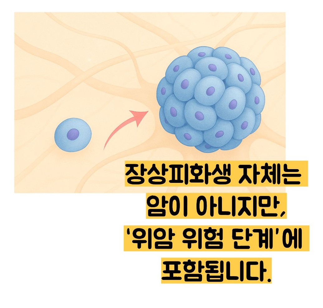 장상피화생 뜻