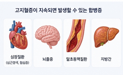 고지혈증이미지