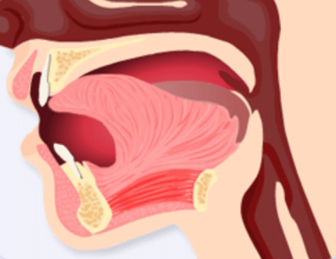 이중턱 없애는 법