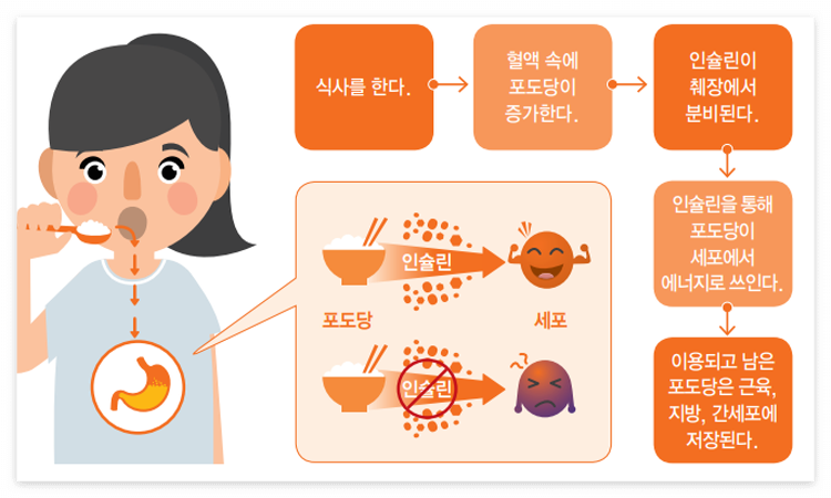 당뇨 초기증상