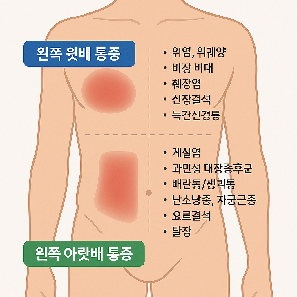 왼쪽배 통증 부위 사진