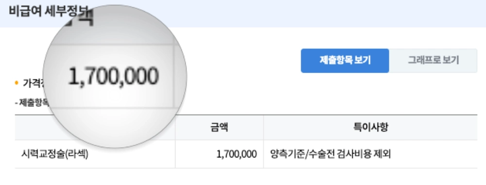 라섹 가격