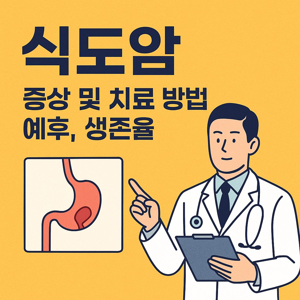 식도암 증상과 치료 방법, 예후와 생존율 정보를 의료 일러스트와 함께 정리한 대표 이미지