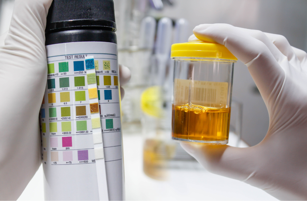 횡문근 융해증 증상