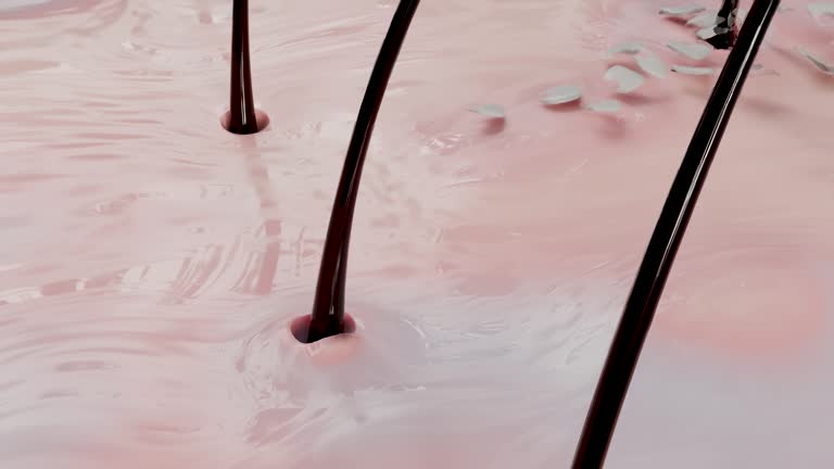 두피 건조와 각질