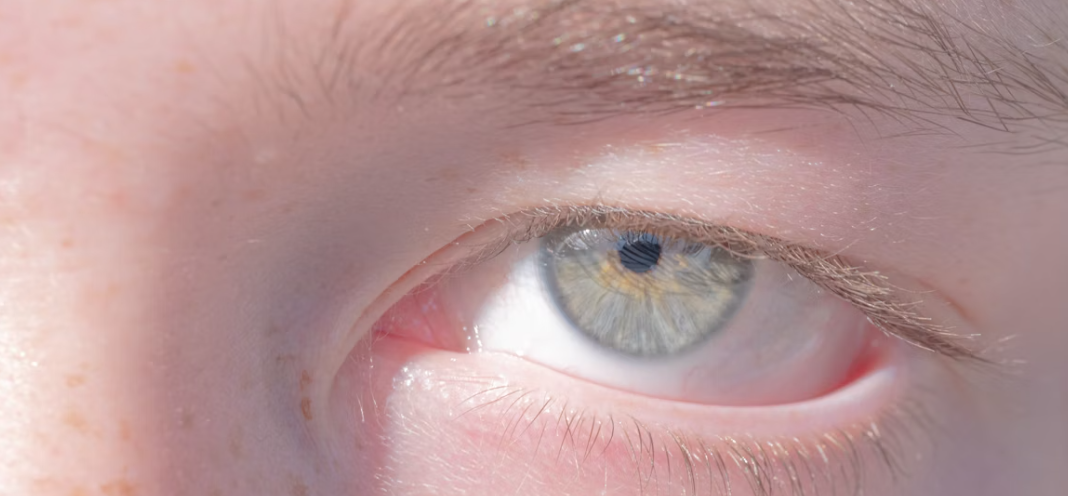 주요 증상과 구분법