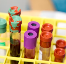 빈혈 증상 원인 치료 방법