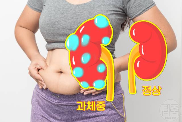 혈압 낮추는 법 다이어트 비만 고혈압 상관관계 신장