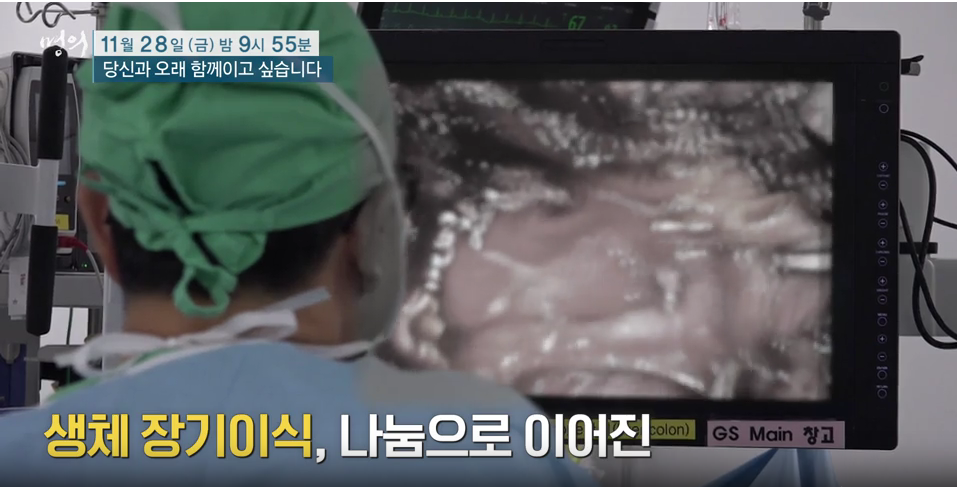 명의 생체 장기 이식