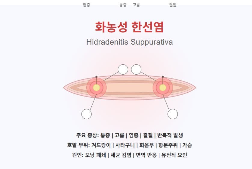 화농성 한선염 완벽 가이드