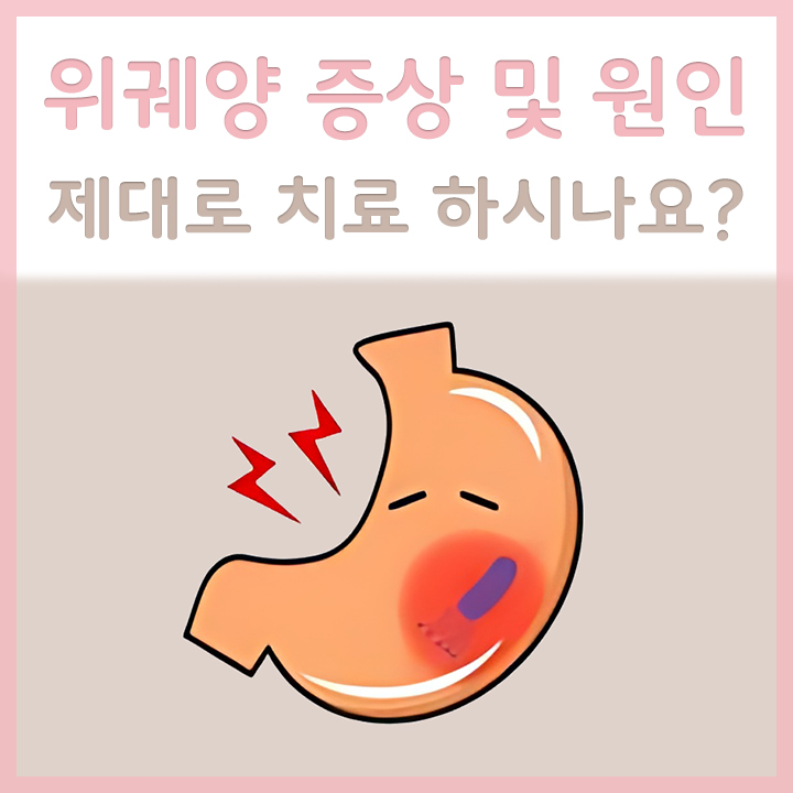 위궤양이-발생한-위의-모습