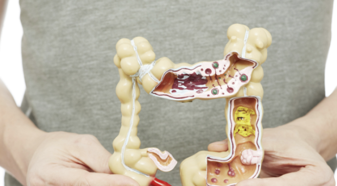 방귀가 많이 나오는 이유 10가지 총정리 섬네일