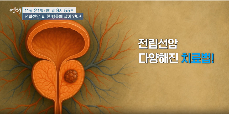 몀의 전립선암 피한방울