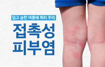 접촉성 피부염 사진