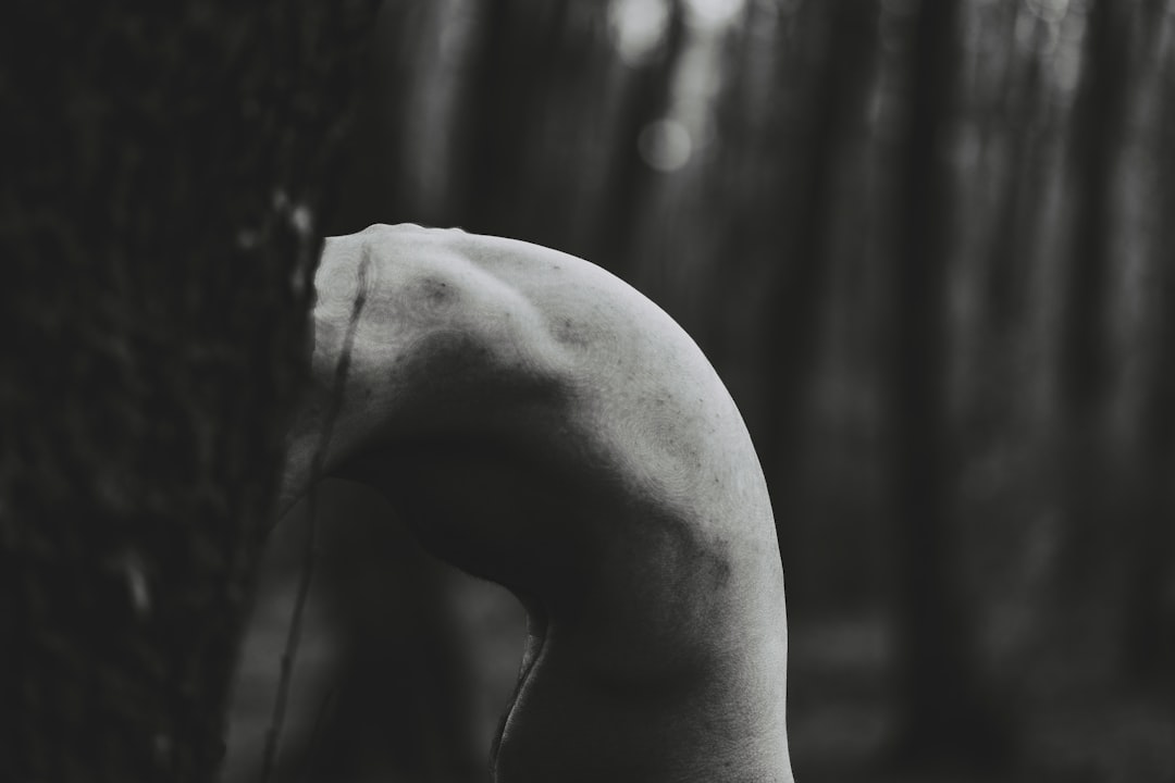 Shin pain.