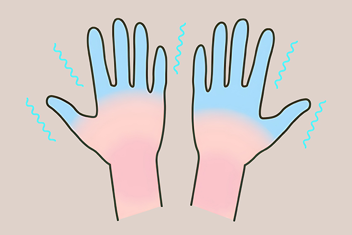 저림증상이-있는-손-모습