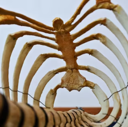 골다공증에 좋은 음식 예방 식단