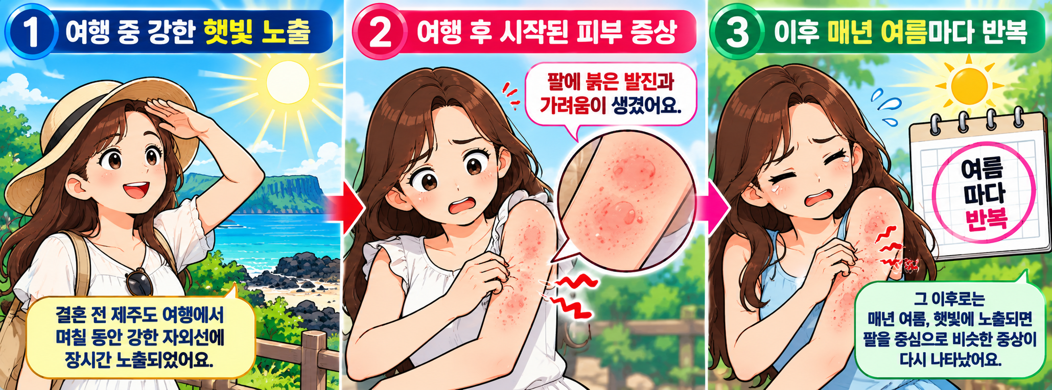여름철 강한 자외선 노출 후 팔에 발생한 붉은 피부 발진과 가려움
