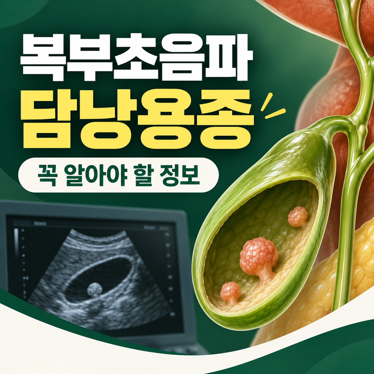 복부초음파 담낭용종