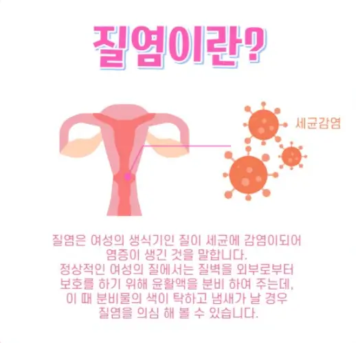 질염